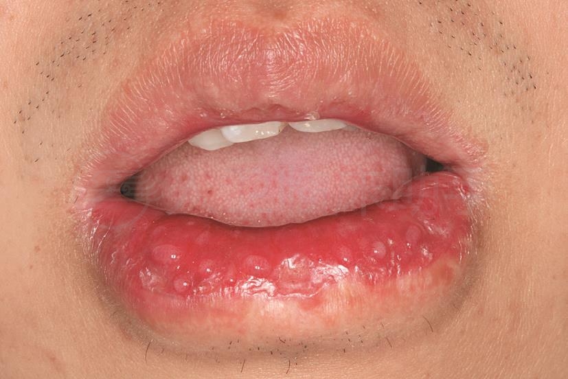 病例详情 病例 人卫临床助手 人民卫生出版社