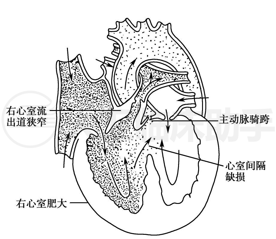 疾病详情 疾病 人卫临床助手 人民卫生出版社