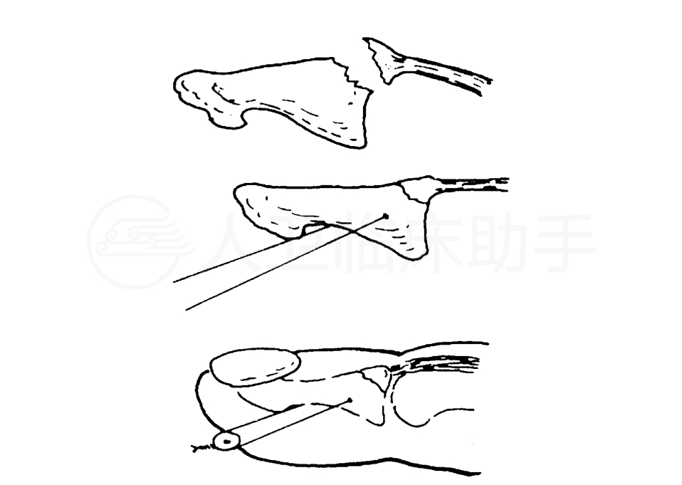 疾病详情 疾病 人卫临床助手 人民卫生出版社