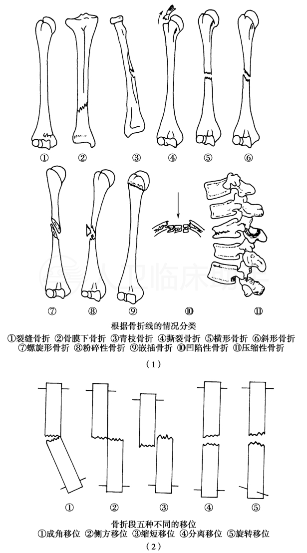 疾病详情 疾病 人卫临床助手 人民卫生出版社