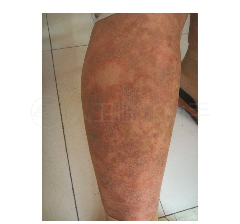 疾病详情 疾病 人卫临床助手 人民卫生出版社