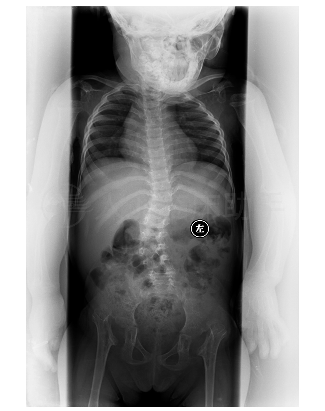 病例详情 病例 人卫临床助手 人民卫生出版社