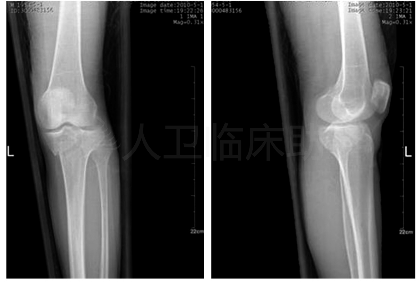 病例详情 病例 人卫临床助手 人民卫生出版社