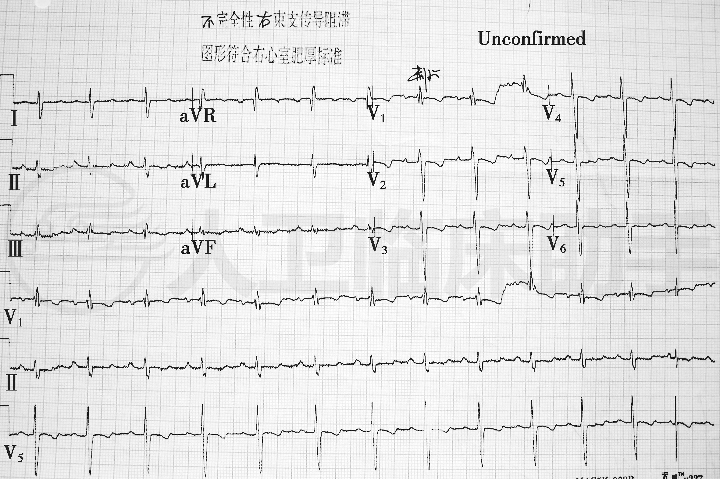 病例详情 病例 人卫临床助手 人民卫生出版社