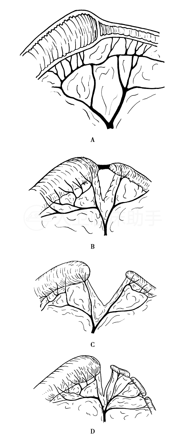 疾病详情 疾病 人卫临床助手 人民卫生出版社