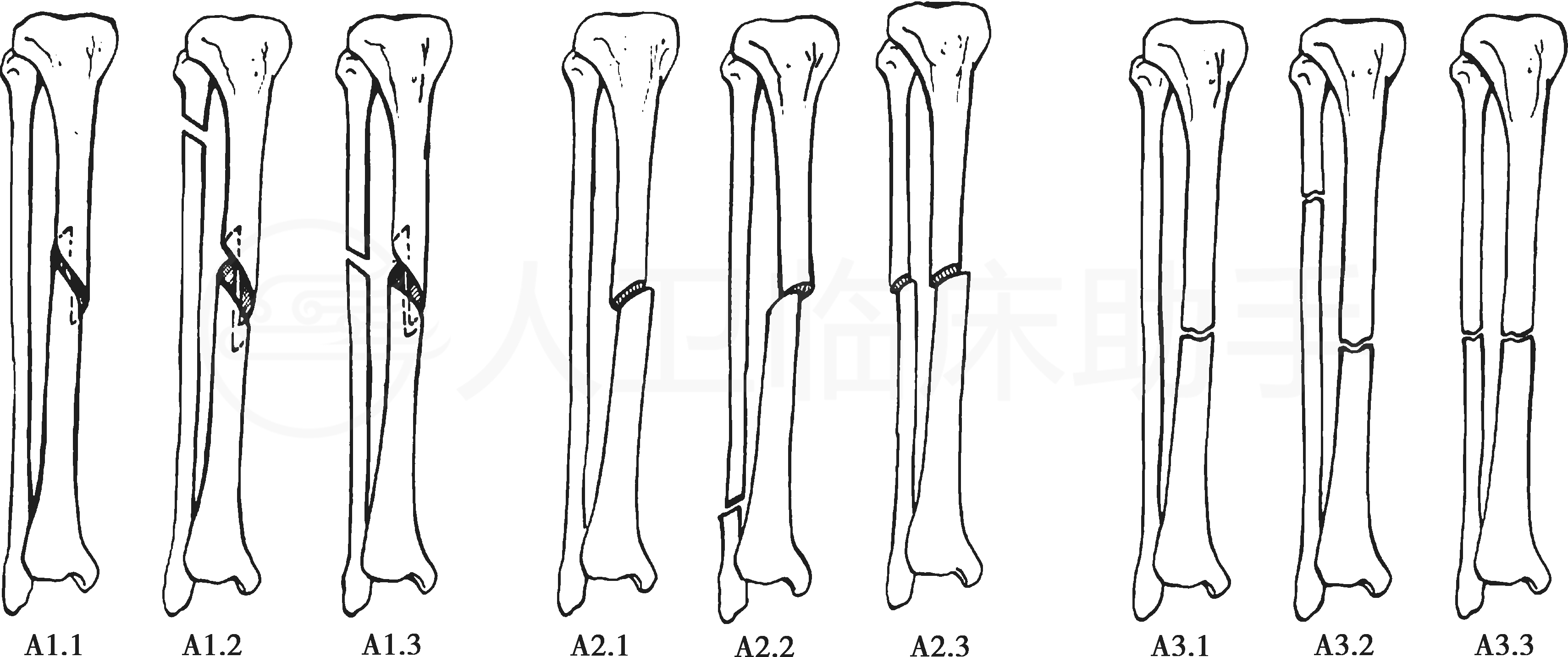 疾病详情 疾病 人卫临床助手 人民卫生出版社